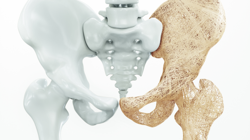 musculoskeletal disorders in seniors - osteoporosis